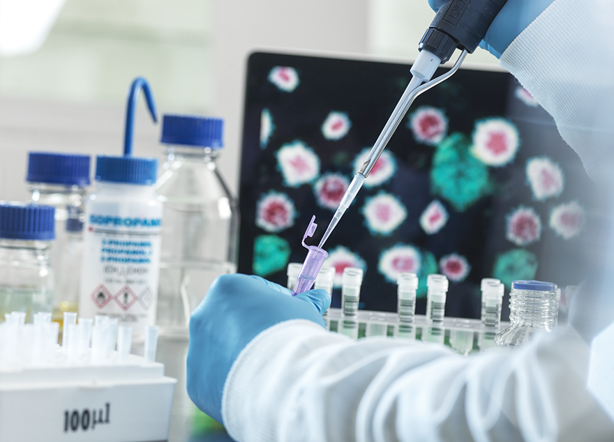 김욱·최상돈 교수팀, 자가면역질환 치료 위한 新 화합물 개발